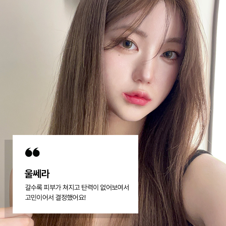 울쎄라 시술후기
