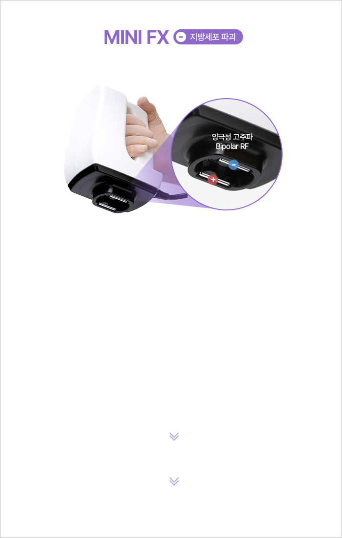시술 부위를 진공하여 RF열에너지를 균일하게 전달 지방세포에 전기에너지를 전달해 세포막 상처 발생 손상된 지방세포 2~4주 뒤 배출되며 지방감소 효과