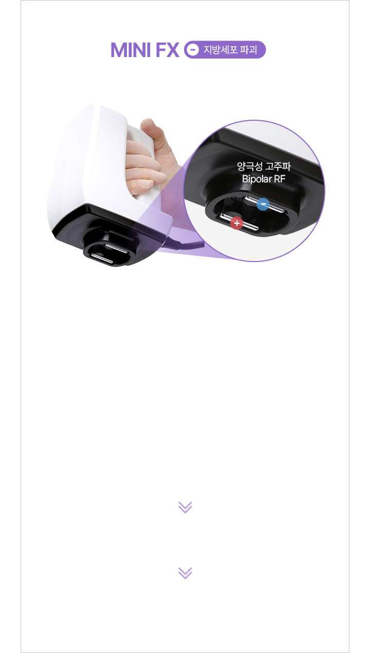 시술 부위를 진공하여 RF열에너지를 균일하게 전달 지방세포에 전기에너지를 전달해 세포막 상처 발생 손상된 지방세포 2~4주 뒤 배출되며 지방감소 효과