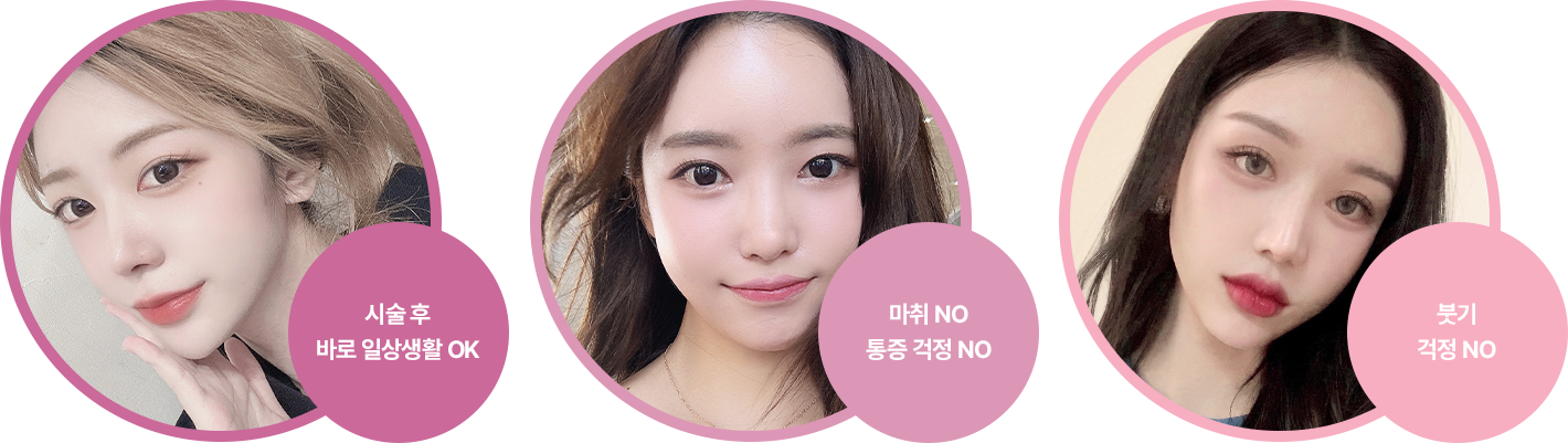 통증 NO, 다운타임 NO 강력한 사파이어 컨택 쿨링 방식으로 시원하고 안전하게 에너지를 전달하여 마취 없이 통증이 거의 없음