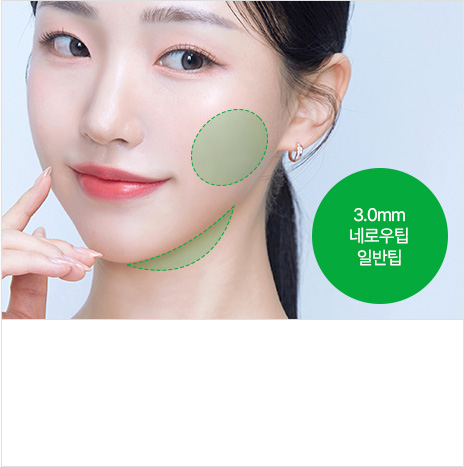 3.0mm 네로우팁 일반팁 지방제거부위 : 심부볼, 이중턱