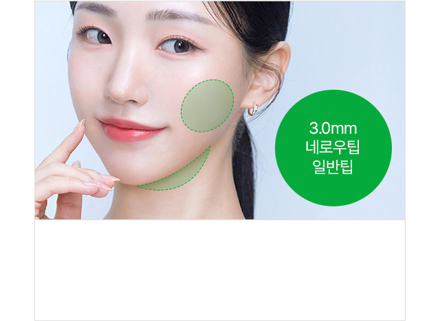 3.0mm 네로우팁 일반팁 지방제거부위 : 심부볼, 이중턱