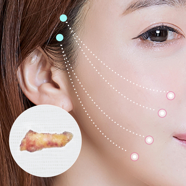 리프팅 하여 잘라낸 스마스층을 눈으로 확인