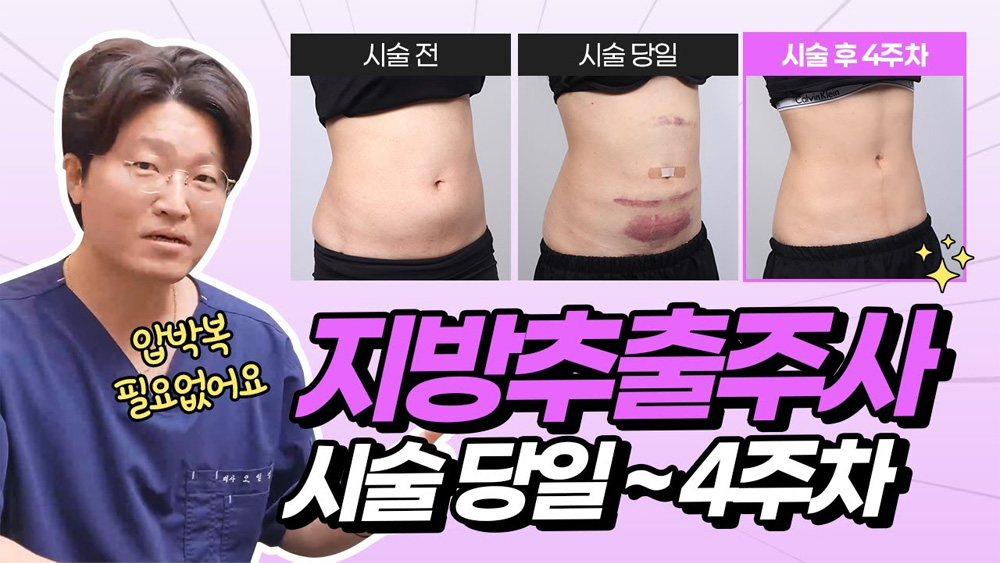 동영상으로 보는 가장 많은, Q&A 썸네일