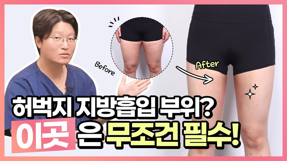동영상으로 보는 가장 많은, Q&A 썸네일