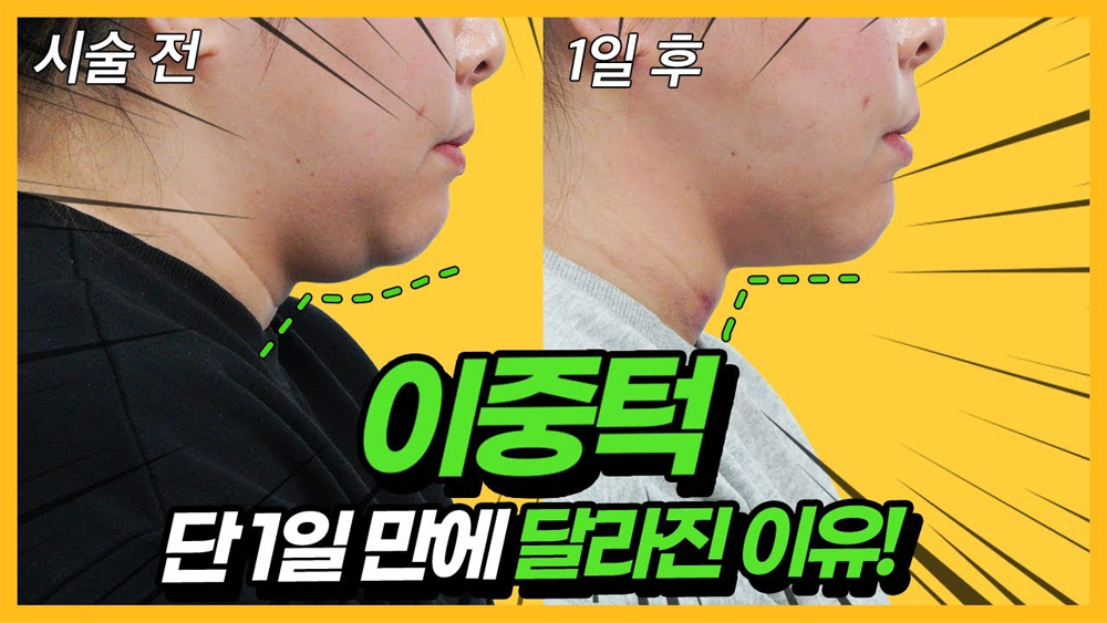 동영상으로 보는 가장 많은, Q&A 썸네일