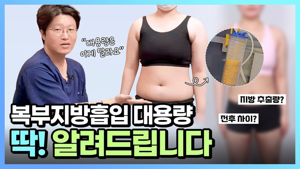 세이예스와 함께하는 성형, Story