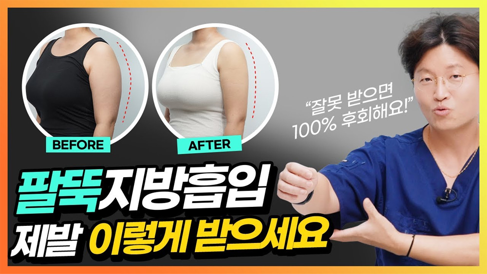 세이예스와 함께하는 성형, Story