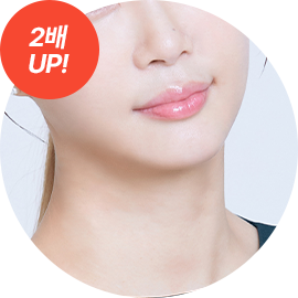 4X 미니리프팅 1cm 최소 절개 중앙부, 하안부 집중 개선으로 V라인 효과적 양쪽으로 당겨 효과도 2배