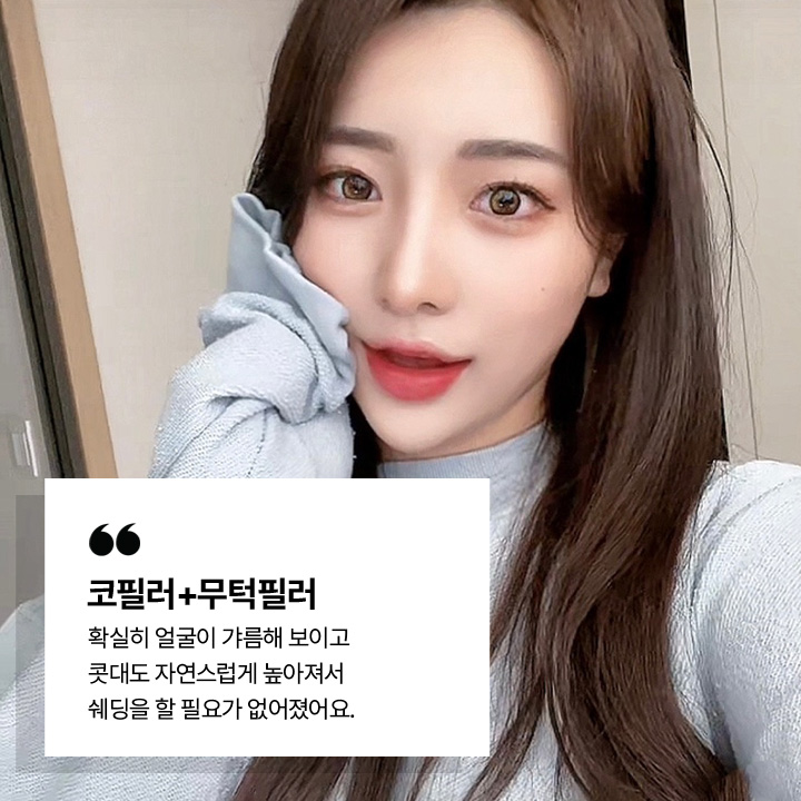 코필러+무턱필러 시술후기