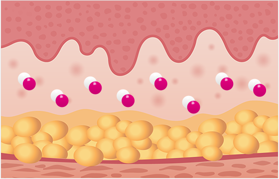 線維芽細胞とコラーゲン繊維がウルトラコール粒子の周囲に再配置