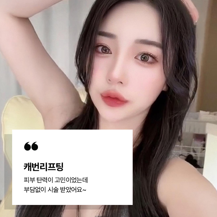 캐번리프팅 시술후기