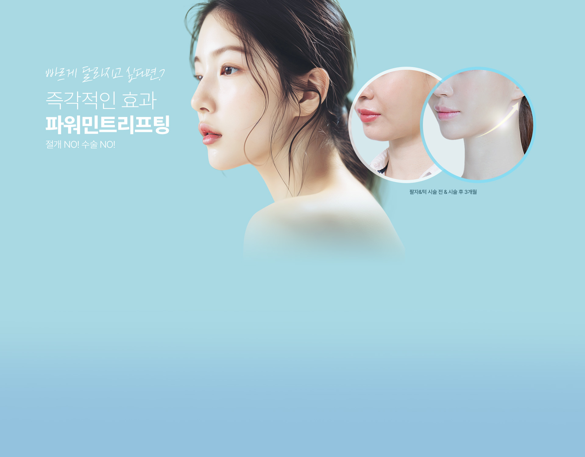 간단한 시술로 안면거상 효과를 느끼고 싶다면? 강한 고정력, 일반 실보다 긴 유지기간, 파워민트리프팅