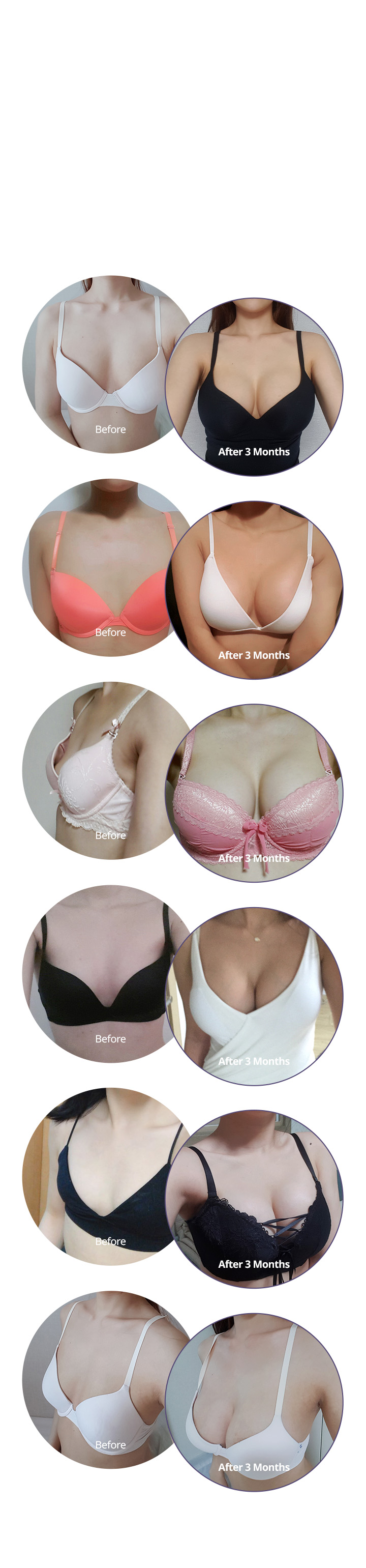 มีรีวิวที่จะพิสูจน์ความเชี่ยวชาญ ด้านการศัลยกรรมเสริมหน้าอกของ SEYYES BEFORE & AFTER