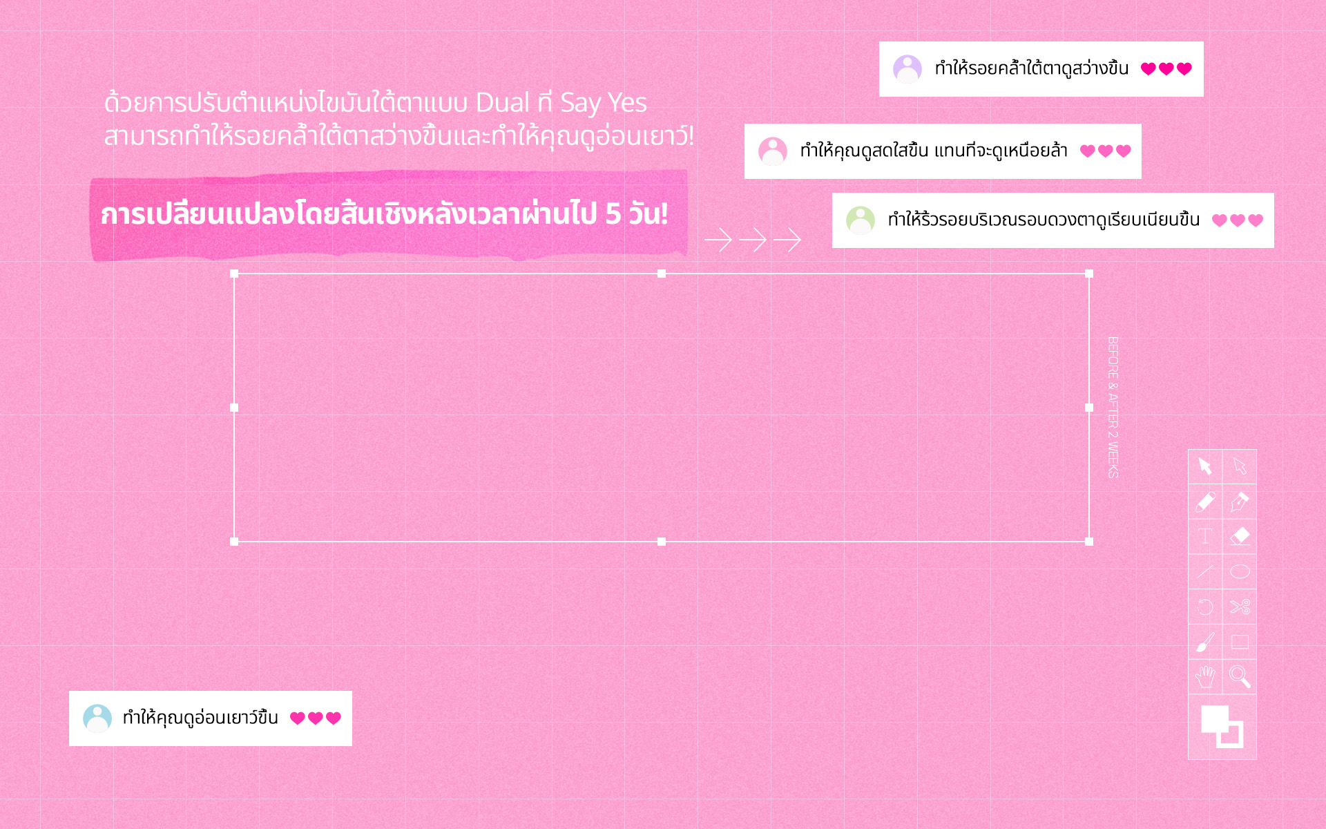 ด้วยการปรับตำแหน่งไขมันใต้ตาแบบ Dual ที่ Say Yes สามารถทำให้รอยคล้ำใต้ตาสว่างขึ้นและทำให้คุณดูอ่อนเยาว์! 