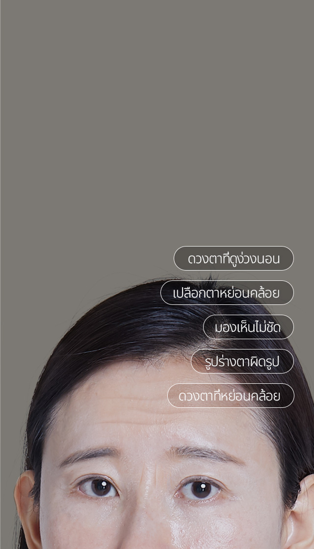 จะได้ดวงตาที่ดูสดใส และอ่อนเยาว์ ด้วย การผ่าตัดยกคิ้ว + หนังตาที่หย่อนคล้อยจากอายุที่เพิ่มขึ้น + รูปตาที่เปลี่ยนไป + ดูเหนื่อยล้าจากการหย่อนคล้อยของเปลือกตา สามารถแก้ไขปัญหาเหล่านี้ได้พร้อมกันทีเดียว!