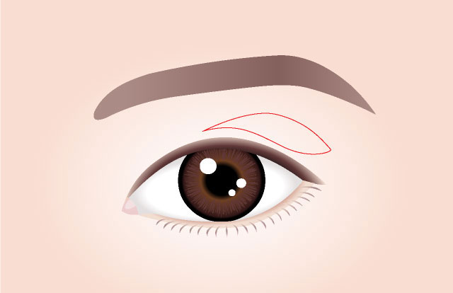STEP 01 การออกแบบ เราออกแบบแผนการผ่าตัดและออกแบบเปลือกตาบน ตามระดับความหย่อนคล้อยและสภาพอายุของแต่ละบุคคล 