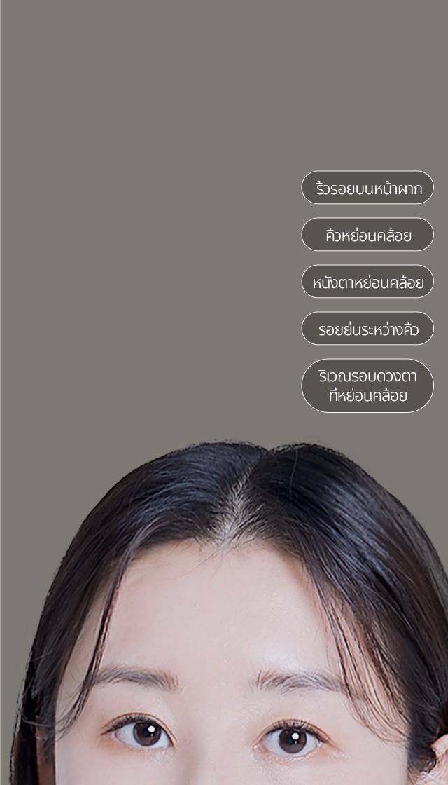 รูปลักษณ์ที่ดูเศร้าไม่สดใส และสัญญาณแห่งความชรา + ดวงตาที่หย่อนคล้อย + คิ้วที่หย่อนคล้อย + รอยย่นระหว่างคิ้ว + ริ้วรอยบนหน้าผาก สามารถแก้ไขปัญหาเหล่านี้ได้พร้อมกันทีเดียว!