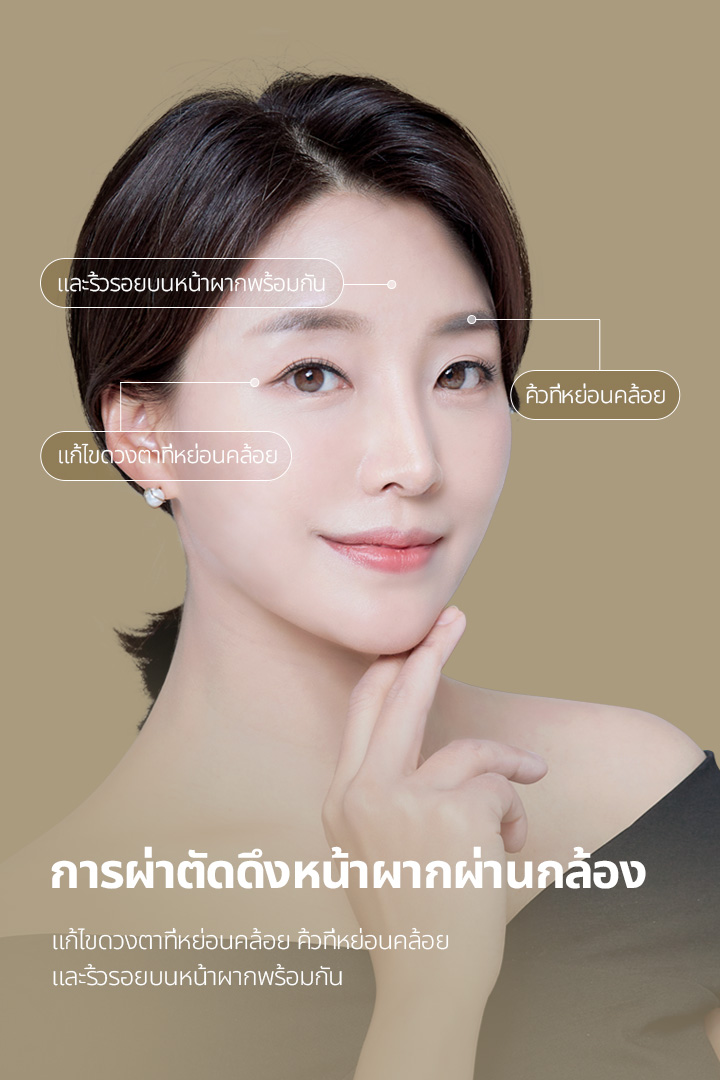การผ่าตัดดึงหน้าผากผ่านกล้อง แก้ไขดวงตาที่หย่อนคล้อย คิ้วที่หย่อนคล้อย และริ้วรอยบนหน้าผากพร้อมกัน
