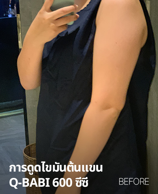 전후사진
