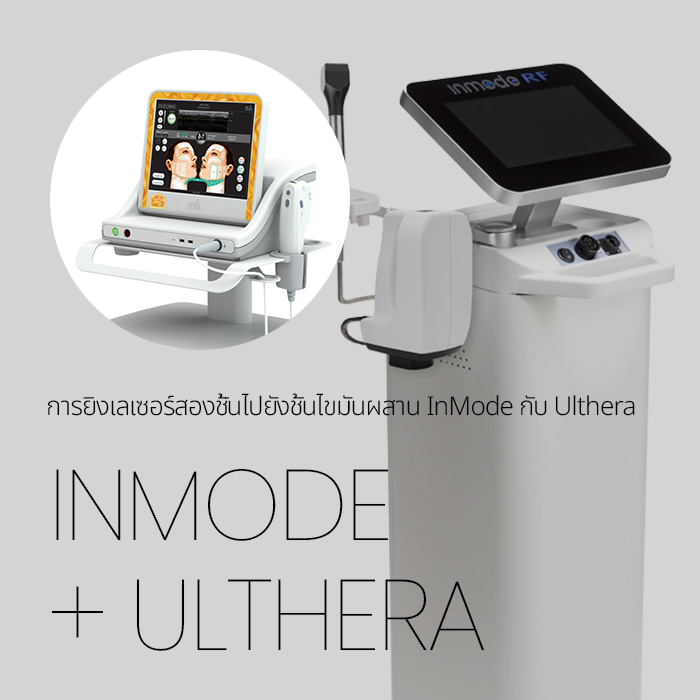 การยิงเลเซอร์สองชั้นไปยังชั้นไขมัน ผสาน InMode กับ Ulthera