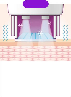 STEP 02 ระบบทำความเย็นเริ่มทำงาน และการปรับจูนอัตโนมัติเริ่มขึ้น ทันทีที่เริ่มต้นการรักษา