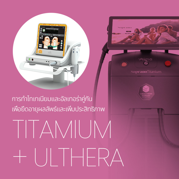 การทำไทเทเนียมและอัลเทอร่าคู่กัน