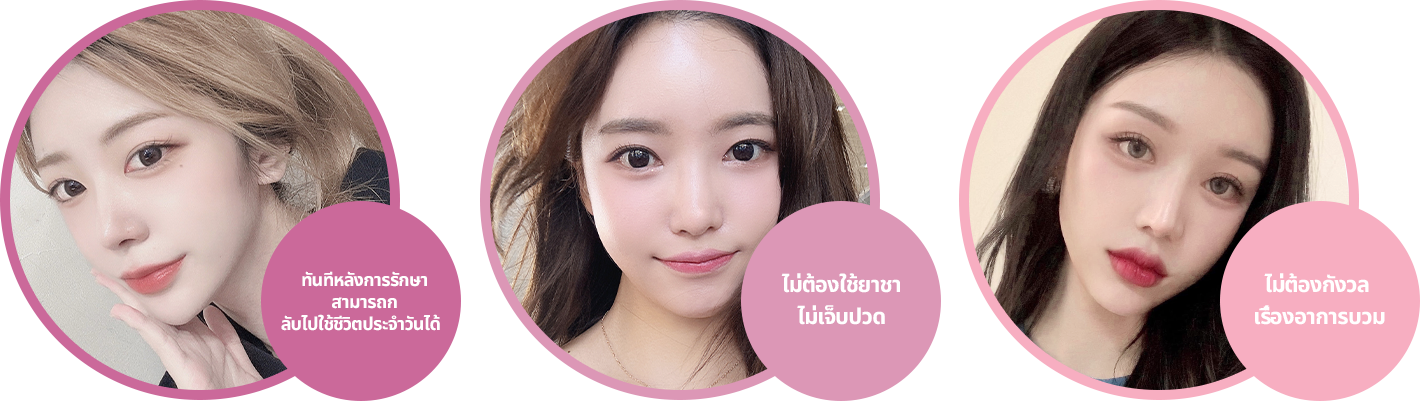 ไม่เจ็บ ไม่ต้องพักฟื้นระบบระบายความร้อนด้วยจุดสัมผัสแซฟไฟร์ที่ทรงพลังช่วยส่งพลังงานอย่างปลอดภัย โดยแทบไม่ก่อให้เกิดการเจ็บปวดแม้จะไม่ใช้ยาชา