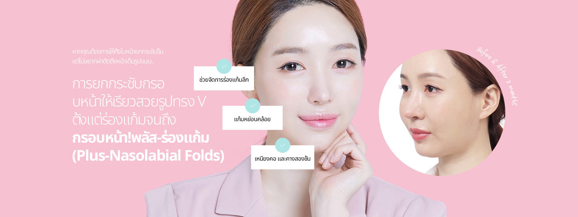 หากคุณต้องการให้ทั้งใบหน้ายกกระชับขึ้น แต่ไม่อยากผ่าตัดดึงหน้าเต็มรูปแบบ การยกกระชับกรอบหน้าให้เรียวสวยรูปทรง V ตั้งแต่ร่องแก้มจนถึง กรอบหน้า! พลัส-ร่องแก้ม (Plus-Nasolabial Folds)