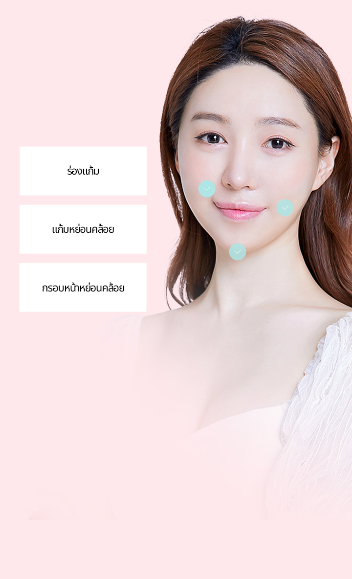 แนะนำสำหรับกรณีต่อไปนี้  1 ผู้ที่ต้องการแก้ปัญหาร่องแก้มและกรอบหน้าไปพร้อมกัน 2 ผู้ที่ไม่ต้องการผ่าตัดยกกระชับใบหน้าเต็มรูปแบบ 3 ผู้ที่ต้องการผลลัพธ์การยกกระชับที่คงอยู่ยาวนานและมีประสิทธิภาพ 4 ผู้ที่ไม่ได้รับผลลัพธ์ที่ชัดเจนน่าพึงพอใจจากการทำเลเซอร์หรือร้อยไหม