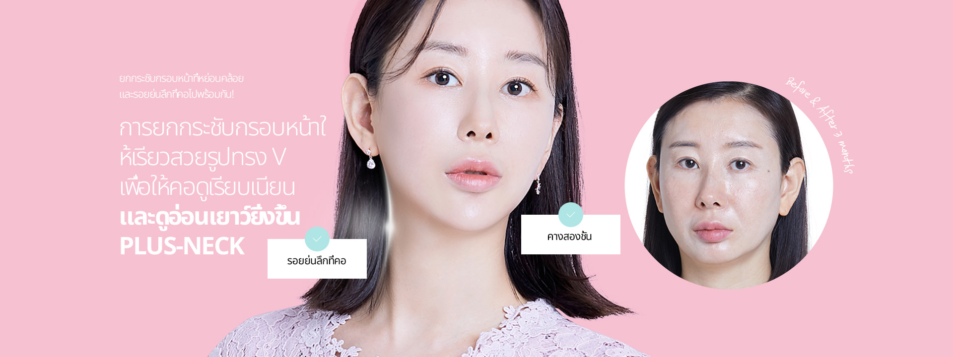ยกกระชับกรอบหน้าที่หย่อนคล้อย และรอยย่นลึกที่คอไปพร้อมกัน! การยกกระชับกรอบหน้าให้เรียวสวยรูปทรง V เพื่อให้คอดูเรียบเนียน และดูอ่อนเยาว์ยิ่งขึ้น Plus-Neck