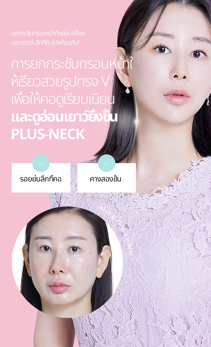 ยกกระชับกรอบหน้าที่หย่อนคล้อย และรอยย่นลึกที่คอไปพร้อมกัน! การยกกระชับกรอบหน้าให้เรียวสวยรูปทรง V เพื่อให้คอดูเรียบเนียน และดูอ่อนเยาว์ยิ่งขึ้น Plus-Neck
