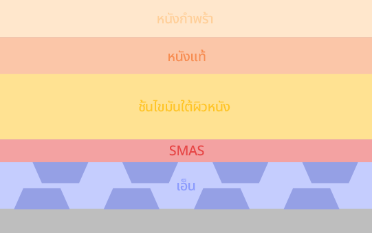 SMAS เป็นชั้นของเนื้อเยื่อพังผืดที่อยู่ระหว่างชั้นไขมันและกล้ามเนื้อในผิว คุณสามารถคาดหวังผลลัพธ์ที่น่าพึงพอใจจากมินิเฟซลิฟท์ได้ เนื่องจากดึงชั้น SMAS ซึ่งปกติเป็นสาเหตุหลักของผิวหย่อนคล้อย 