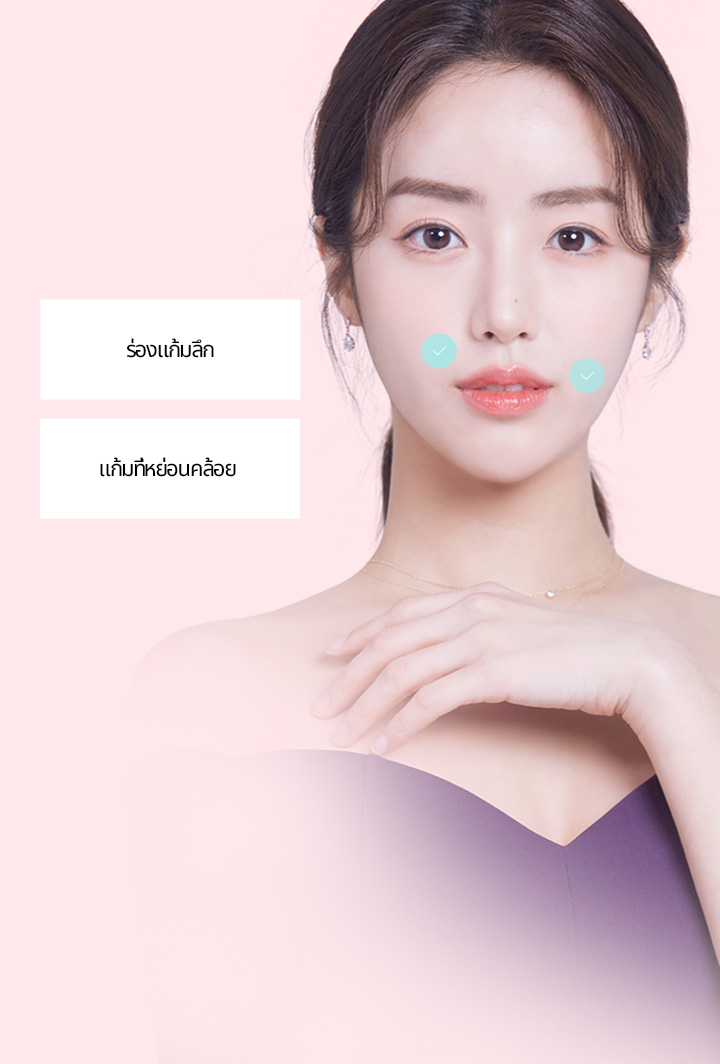 แนะนำสำหรับกรณีต่อไปนี้  1 ผู้ที่ไม่ต้องการผ่าตัดยกกระชับใบหน้า 2 ผู้ที่กังวลเกี่ยวกับริ้วรอยแห่งวัยบริเวณแก้ม รอบปาก และกรอบหน้า 3 ผู้ที่ต้องการปรับลุคให้ดูอ่อนเยาว์ขึ้น 4 ผู้ที่ไม่ได้รับผลลัพธ์ที่ชัดเจนน่าพึงพอใจจากการทำเลเซอร์หรือร้อยไหม