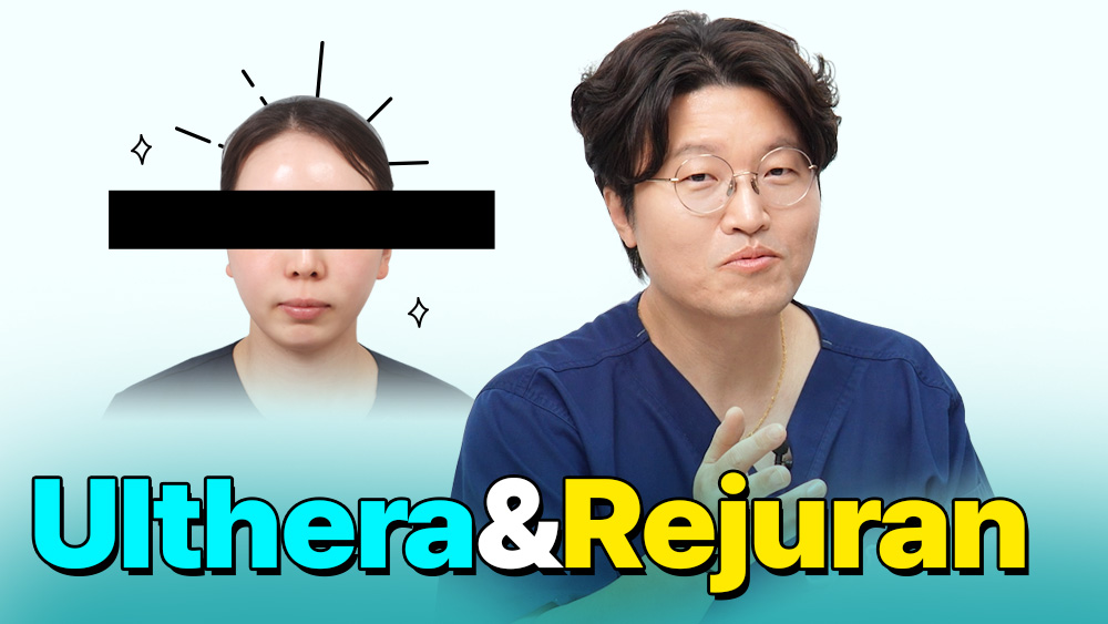 동영상으로 보는 가장 많은, Q&A 썸네일