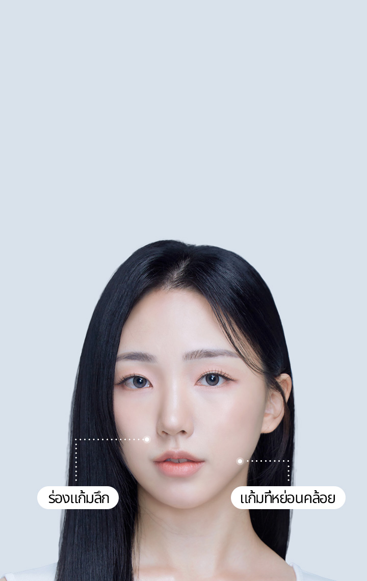 4X มินิ ลิฟท์สำหรับร่องแก้ม รีเซ็ตอายุใบหน้าของคุณในเวลาเพียง 30 นาที