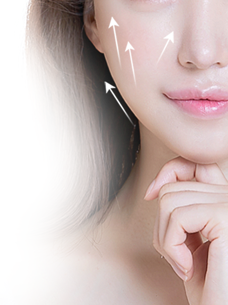 4X มินิ ลิฟติ้ง ยกในแนวตั้ง/แนวเฉียง การเกาะยึดในแนวตั้ง/แนวเฉียง เพื่อใบหน้าและกรอบหน้าที่เรียวขึ้น (รูปตัว V)