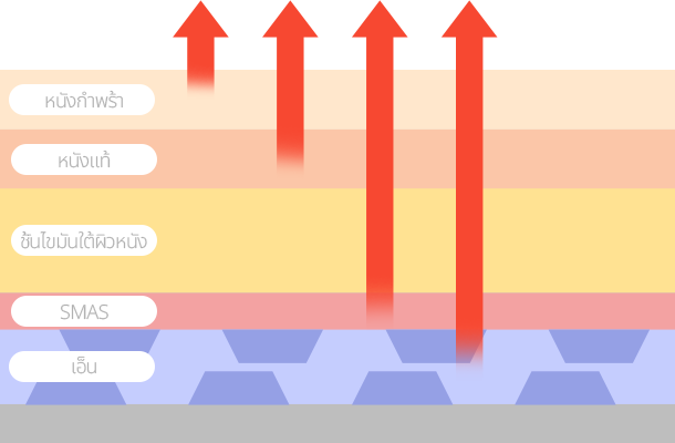 ชั้นผิวหนัง ชั้นหนังแท้ ชั้น SMAS และเอ็นยึดผิว เพิ่มผลลัพธ์การยกกระชับสูงสุดด้วยการตัดเอ็นยึดและดึงให้กระชับขึ้นถึงชั้น SMAS! 