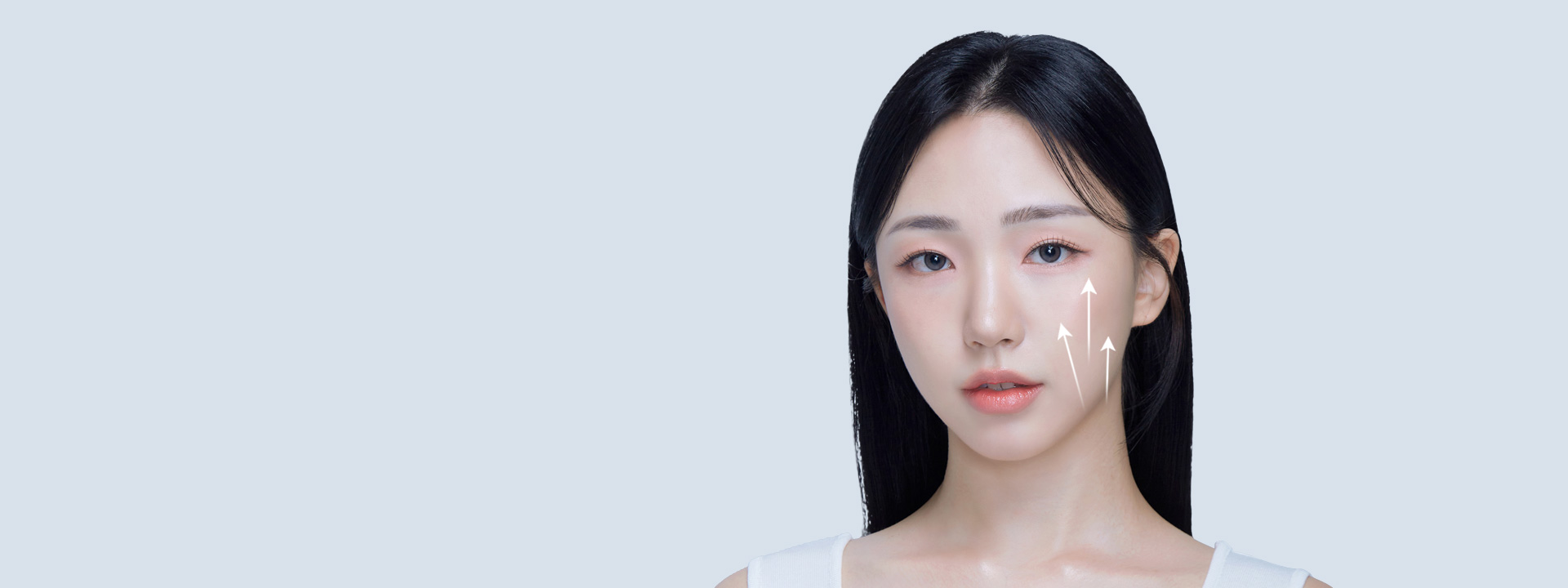 การใช้เส้นไหมยกกระชับ เพื่อดึงชั้น SMAS ผิวชั้นนอกและชั้นหนังแท้ 4X มินิ ลิฟติ้ง