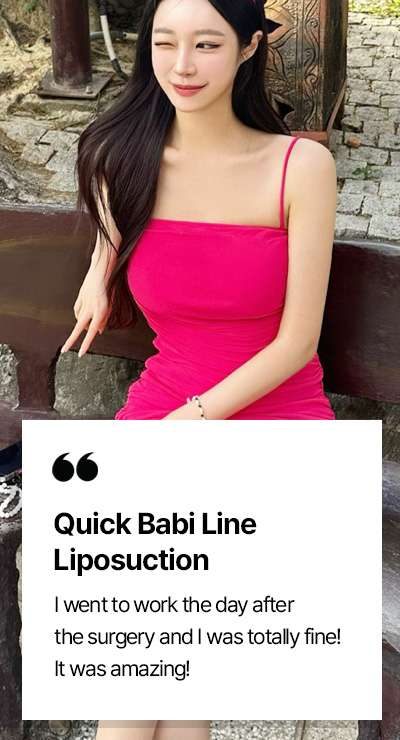 퀵바비라인 시술후기
