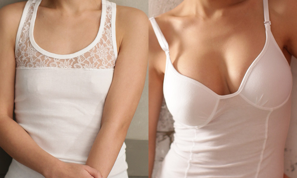 If you don't want to waste the extracted fat then you can opt to inject the extracted fat into the breasts to create water drop shapes Fat Bra 전후사진