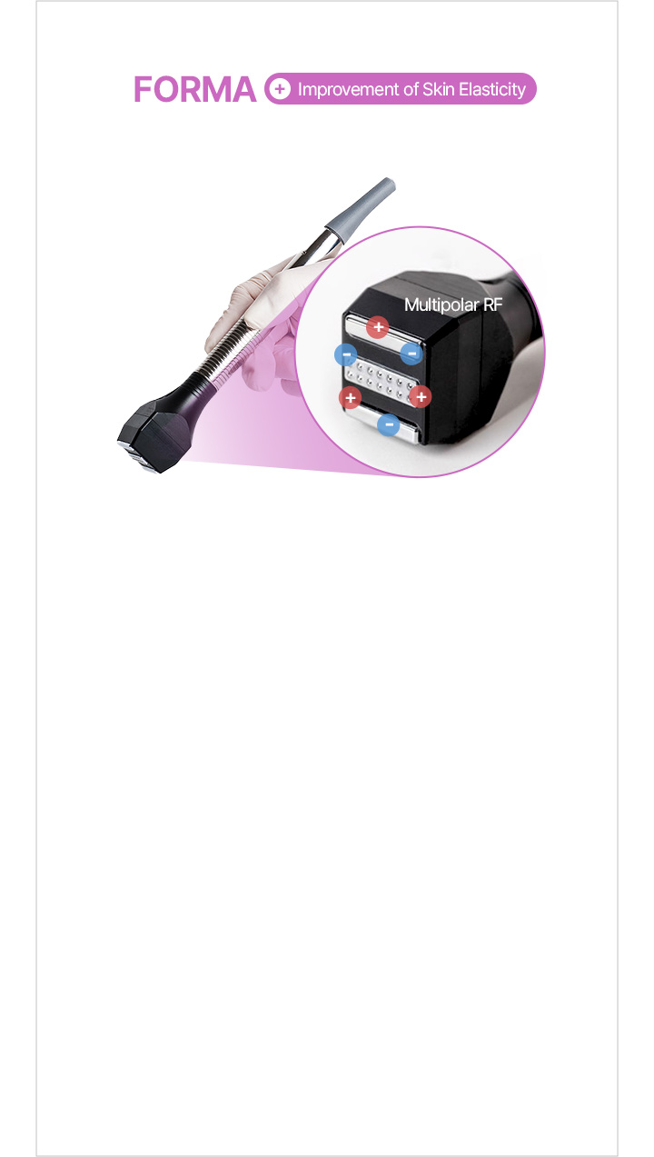 The dermis is stimulated with heat (43°C) Multi-polar energy is delivered for collagen remodeling >Collagen and elastin production improves skin elasticity and skin texture