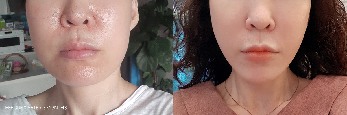 Real-Life Treatment Results