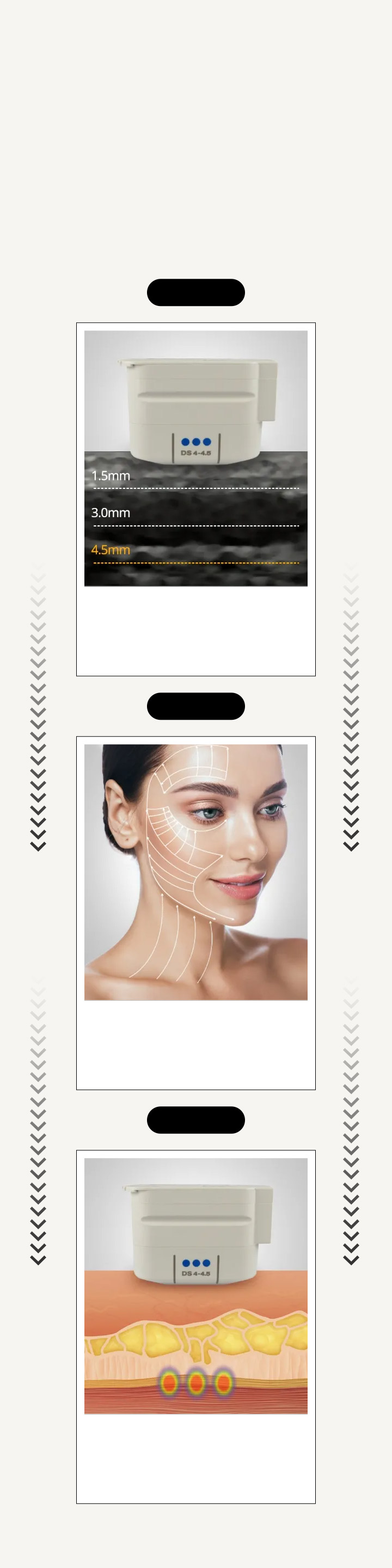 Visible Lifting Effect, Ultherapy Prime