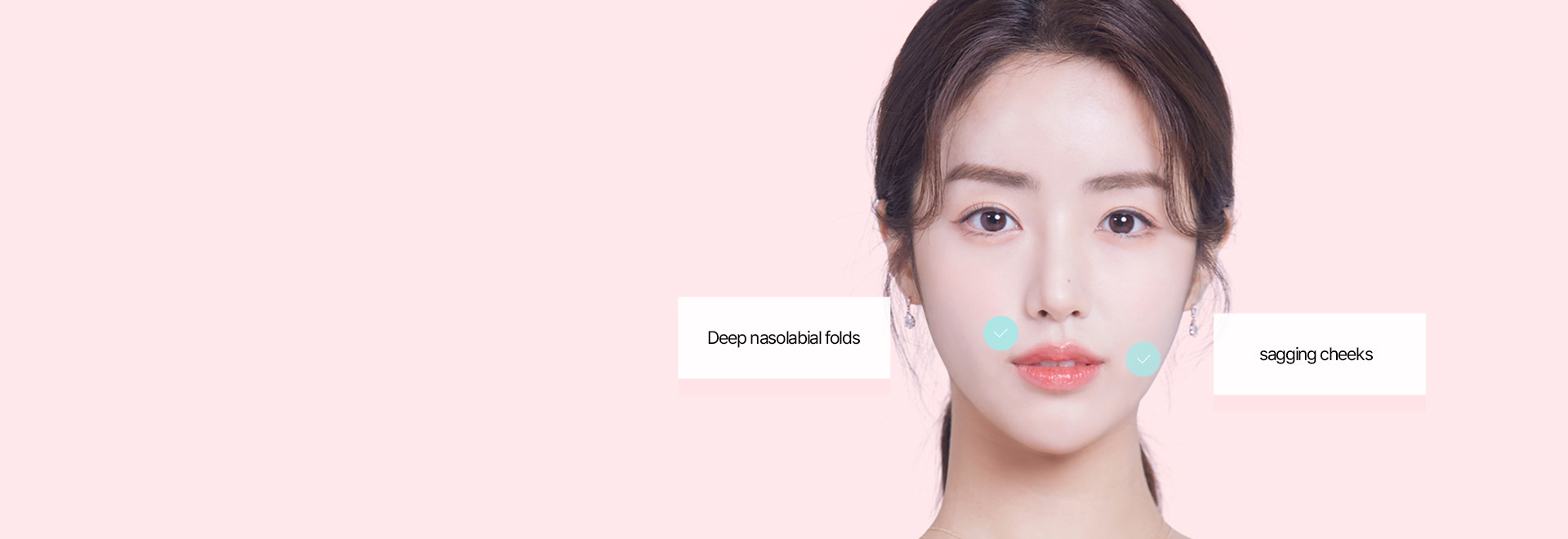 It is recommended for 1 those who don’t want to undergo a facelift  2 those who are concerned about the signs of aging in the cheek area, mouth area, and jawline 3 those who want to look more youthful 4 those who have not seen any noticeable results with laser or thread lift procedures