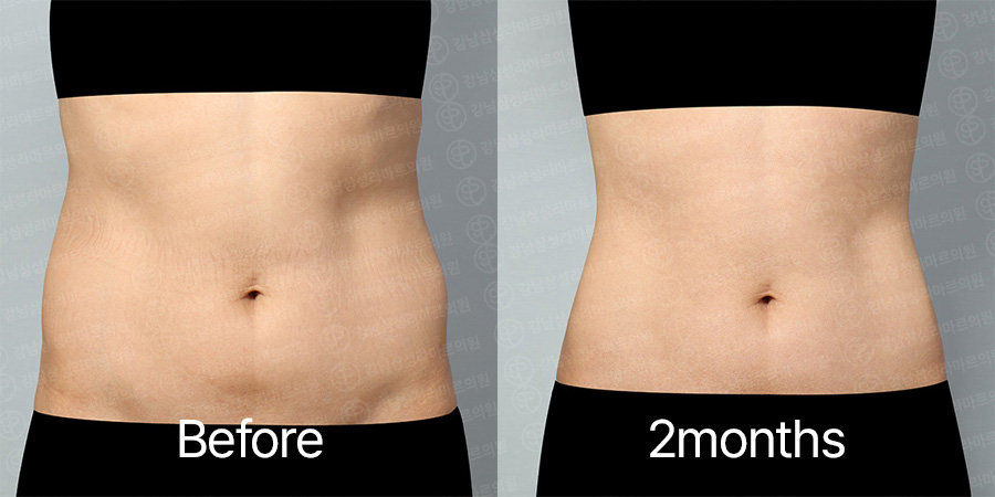 LookFat b&a photo