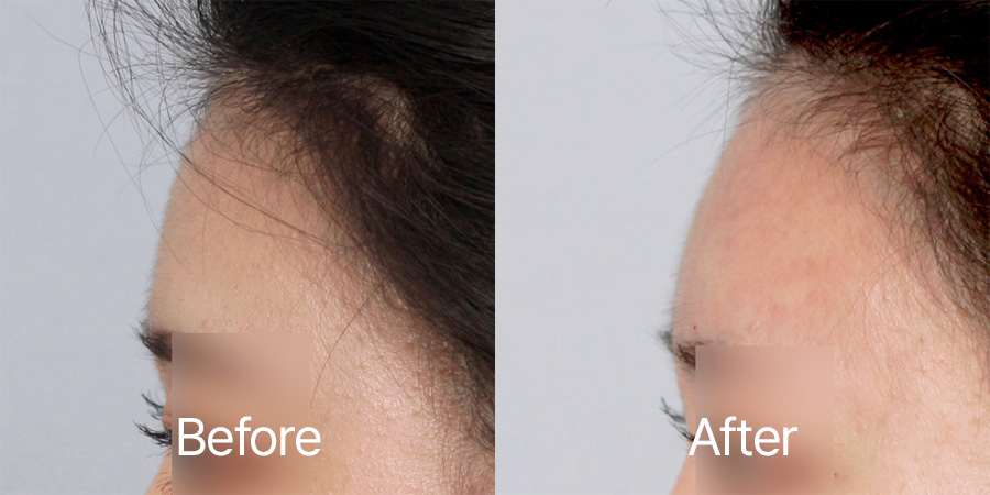 Petite b&a photo