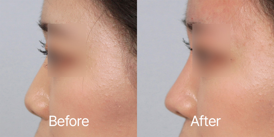 Petite b&a photo