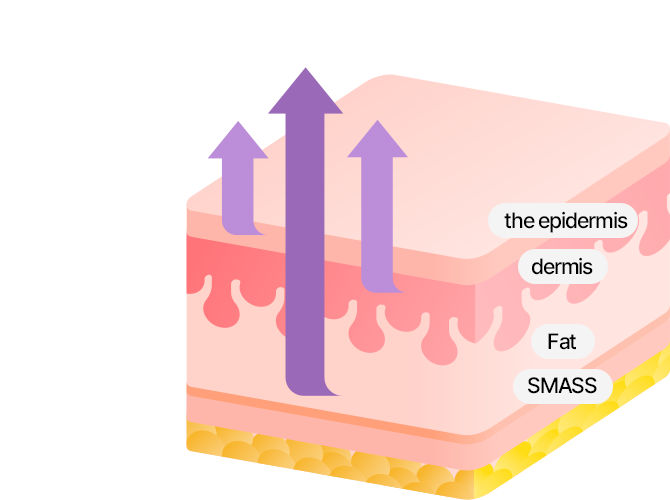 SAYYES 4X Mini Lifting pulls up the epidermis, dermis, SMASS, and retaining ligaments and lifts the sagging skin from the inside for a maximum effect!