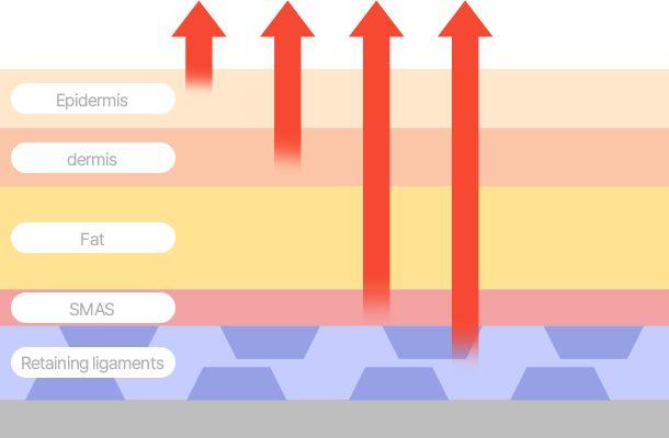 Epidermis, dermis, SMAS, and retaining ligaments Maximized lifting effect by breaking the retaining ligaments and pulling up to the SMAS!
